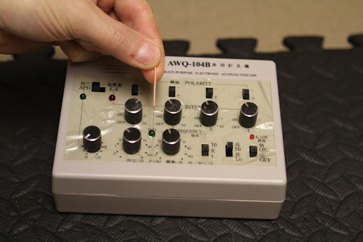 Here he is showing an acupuncture needle and a transcutaneous electrical nerve stimulation (TENS) unit, which sends soothing pulses through electrodes during the acupuncture process.