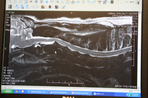A closer look at Francesca's problem area. Dr. Joseph pointed out that there are other lesser bulges along Francesca's spine.