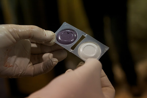 To protect the area from becoming infected, a plug was made using a special dental compound impression material.