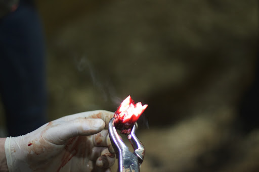 And behold! Twenty minutes later the bad tooth was successfully pulled!