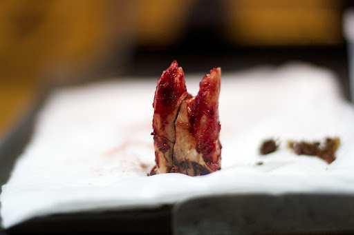 Here's the tooth reassembled for the camera.