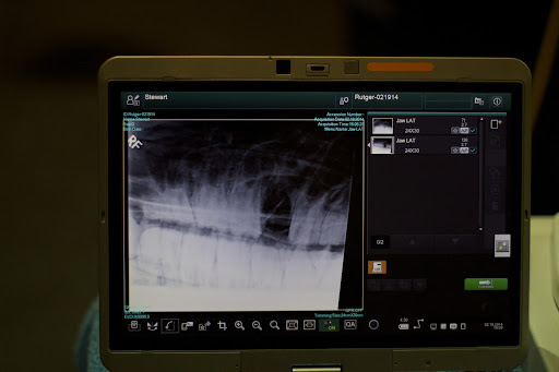 It was a clean pull! No fragments left.