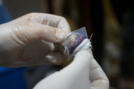 The two parts were combined.